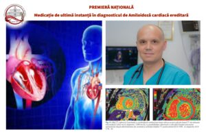Premieră națională în tratamentul amiloidozei cardiace
