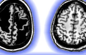Paradoxul creierului lui Daniel Carr