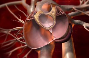 Prima procedură de închidere a unei malformații cardiace congenitale (Foramen ovale patent) prin cateterism cardiac, realizată de parte Spitalul Universitar de Urgență Militar Central „Dr. Carol Davila, partener al Jurnalului Bucureștiului